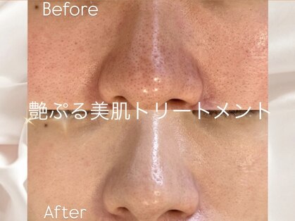 ラリュンヌ(La Lune)の写真