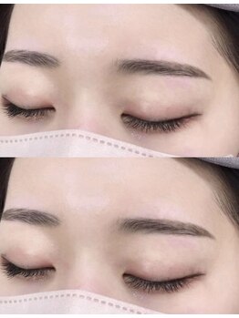 エムラッシュ(М LASH)/wax脱毛