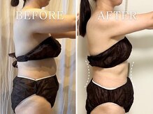 ヨサパーク ニコナ 三軒茶屋南口(YOSA PARK nicona)/体重－5.6キロ・体脂肪-10％