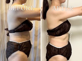 ヨサパーク ニコナ 三軒茶屋南口(YOSA PARK nicona)/体重－5.6キロ・体脂肪-10％