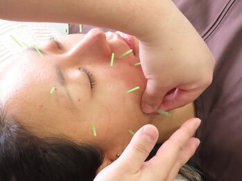 整骨院トリデ(整骨院TORIDE)/ダーマ×幹細胞+美容鍼で効果↑