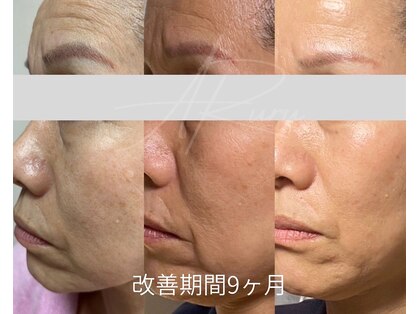 アルルプラス 南草津(ARuru+)の写真