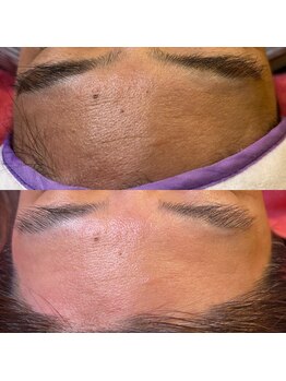 コモドアイラッシュ(comodo eyelash)/マリムーブフェイシャルワックス