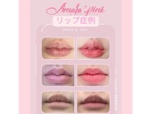 フジモトサロン 那覇おもろまち店(fujimotoサロン)の雰囲気（韓国/アマラピンク/ローマピンク/美白/黒ずみ/バストケア/くすみ）