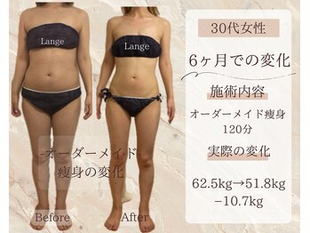 サロン ド ボーテ ラーンジュ 岐阜店(salon de beaut'e L'ange)/ハイパ-ナイフEX2ダイエット痩身