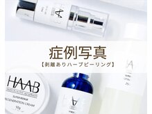 リノア 柏(Lino'a)/本気の肌質改善｜ハーブリプロ