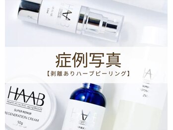 リノア 柏(Lino'a)/本気の肌質改善|ハーブリプロ