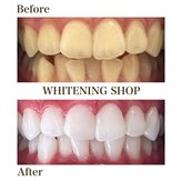 ホワイトニングショップ 尾道店(WHITENING SHOP)