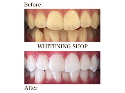 ホワイトニングショップ 尾道店(WHITENING SHOP)の写真