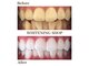 ホワイトニングショップ 尾道店(WHITENING SHOP)の写真