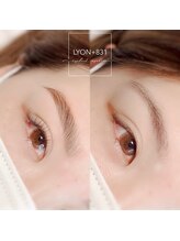 リヨン(LYON+831)/