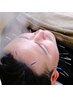 【出来る男の新常識】疲れ顔や眼精疲労も解消！美男子美容鍼　約30分