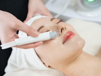 シェリー(SHERRY)の写真/頑固な汚れも除去！毛穴レスなうるツヤたまご肌へ♪