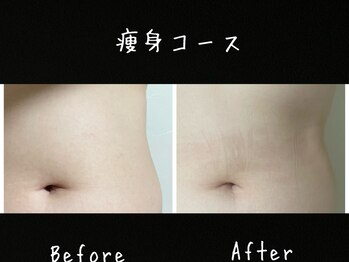 フィールグルック(Viel Gluck)/痩身コース