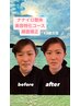 美容特化コース　顔面矯正