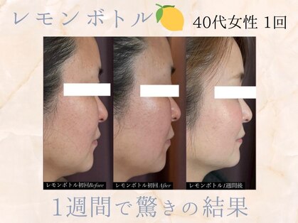 シャングリラ(Shangri-La)の写真