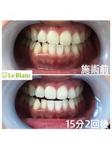 ルブラン 奈良店(Le Blanc)/男性のお客様！抜群の効果！