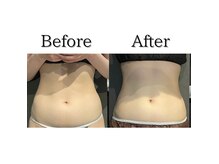 アッヴェリーレ(A'bbellire)