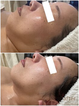 ピュウリリアーナ(Piu liliana)/