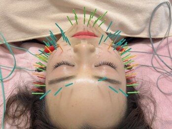 ワッカ 広尾(WACCA)の写真/肌のハリ感UP&引締めなど美肌効果◎肌のお悩み改善!【美容鍼(100本電気鍼+マッサージ+首矯正)60分】