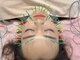 ワッカ 広尾(WACCA)の写真/肌のハリ感UP&引締めなど美肌効果◎肌のお悩み改善!【美容鍼(100本電気鍼+マッサージ+首矯正)60分】