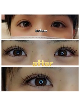 グリッターネイル(GLITTER NAILS)/セラムラッシュリフト