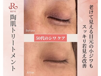 ククル(KUKULU)の写真