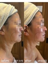 フロル(FLOR)/FLOR【根本改善専門店】