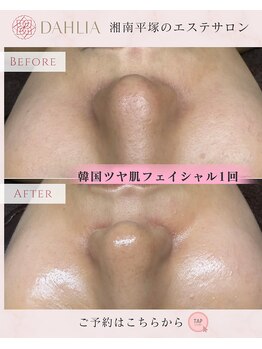 ダリア(DAHLIA)/毛穴が目立つ,ツヤ玉が欲しい