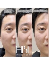 トゥルヌソル 宇都宮(tournesol)/ハリウッドブロウリフト