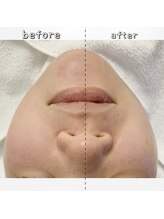 エクスクラメーションマーク(!!!)/片側のみ照射！