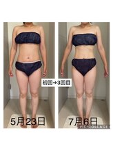 ベレテ(Belete)/お客様 Befor After