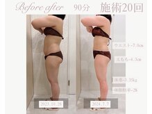 パルタージュ(Partage)/デトックス痩身エステ