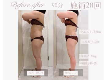 パルタージュ(Partage)/デトックス痩身エステ