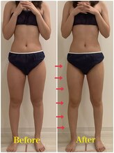 スペチアーレ 夙川/浮腫みが取れて脚長に