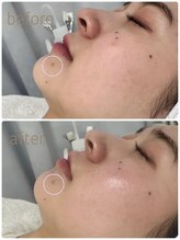 グレイス アンド ミューズ(grace&muse)/【クリスティーナ】ビオフィート