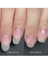 ココ(COCO)/ハンドケア・自爪育成・深爪育成