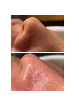 ディシェーレ アスト/ハイドロフェイシャル