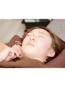 鍼灸施術を受けたい