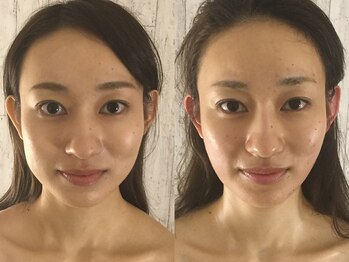 グレースフィオーレ 自由が丘店(gracefiore)