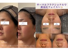 ユフラ(Juhla)の雰囲気（【切らない小顔リフト】近隣希少1度でここまで変わる★）