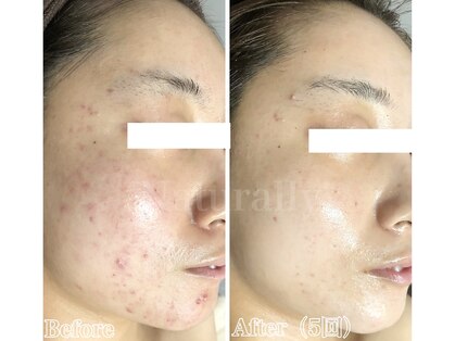 ナチュラリー 佐賀(Naturally)の写真