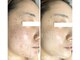 ナチュラリー 佐賀(Naturally)の写真