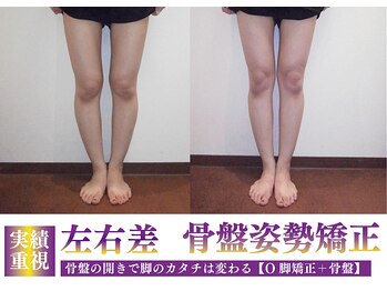 モアフェイス 池袋店(More Face)/【骨盤姿勢矯正】