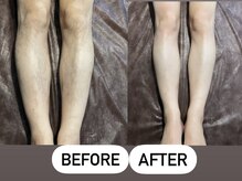 ソーレエルーナ(SOLE e LUNA)/光脱毛 メンズ脱毛 ワックス脱毛