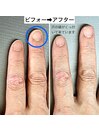 夏は自爪育成しやすい季節