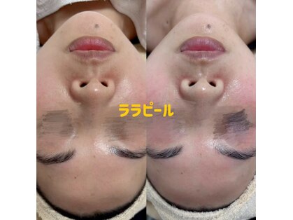 クリーン アンド ビューティーの写真