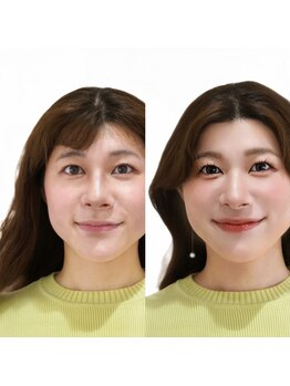 メゾンカラクル/お客様before→after