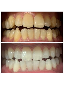 ホワイトプラン/13回目の変化☆