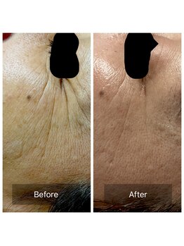 ビジュープラス 筑西下館店(Bijou+)/